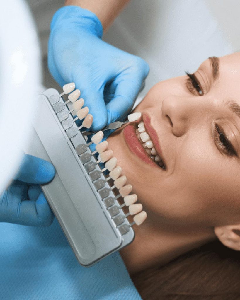 Veneer Treatment Guide Alldent Diş Polikliniği